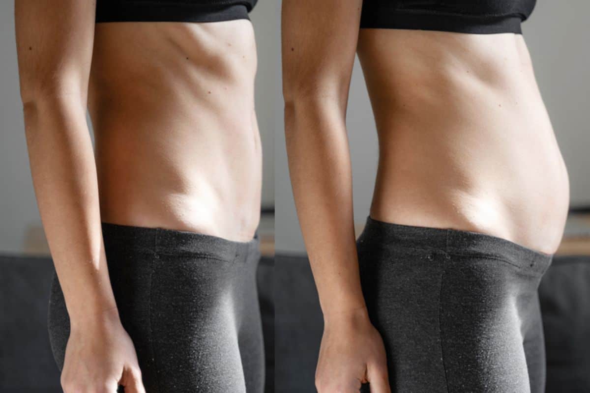 How long does diastasis recti take to improve Thatcham?