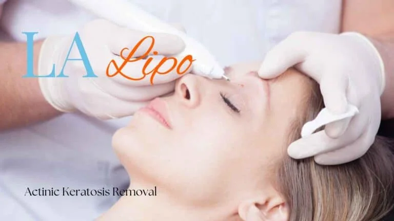 Woman receiving Actinic Keratosis Removal Treatment Thatcham