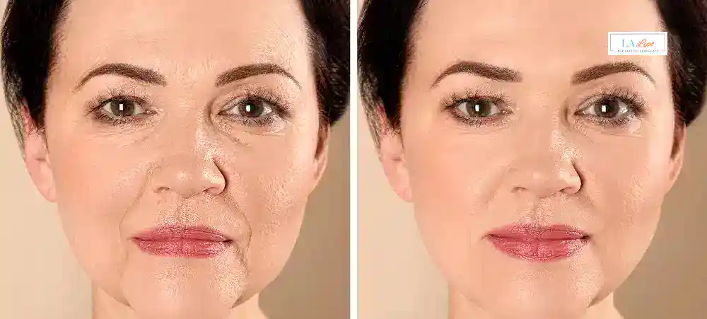Why Aren’t My Skincare Products Making My Sagging Skin Look Firmer Thatcham?