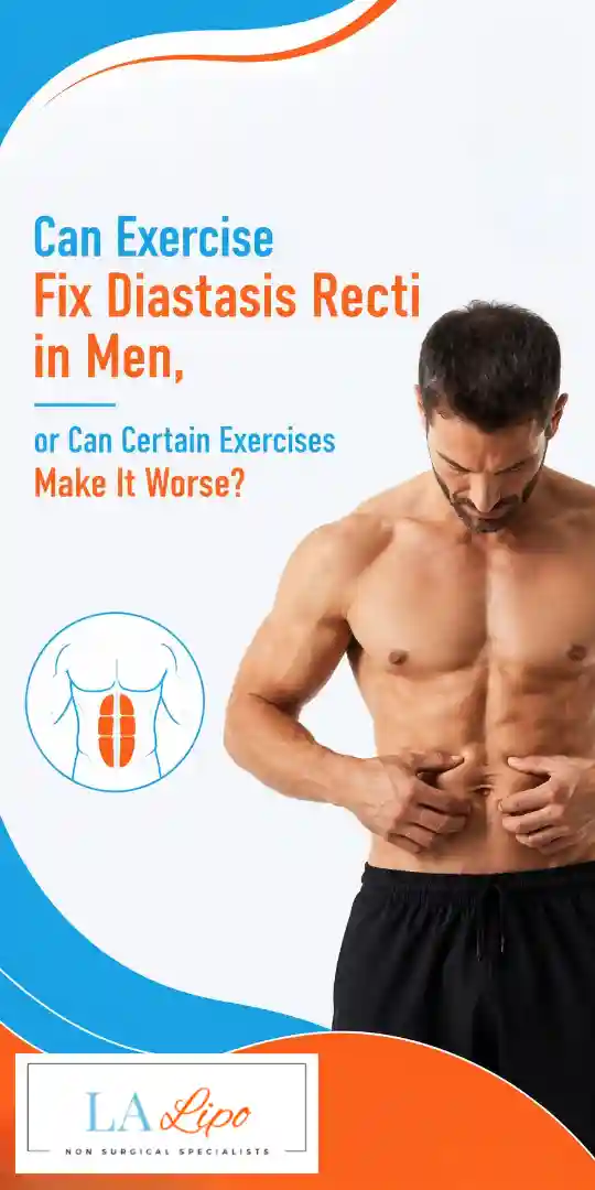 Can Exercise Fix Diastasis Recti in Men, or Can Certain Exercises Make It Worse Thatcham?